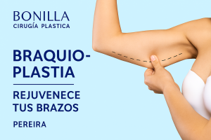 Braquioplastia - Cirugía de brazos -Dr. Ricardo Bonilla. Pereira
