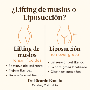 Lifting de muslos en Pereira - Dr. Ricardo Bonilla